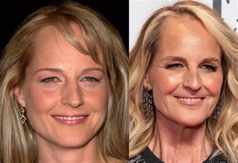 Helen Hunt S Plastic Surgery See Her Face Before And After Photos