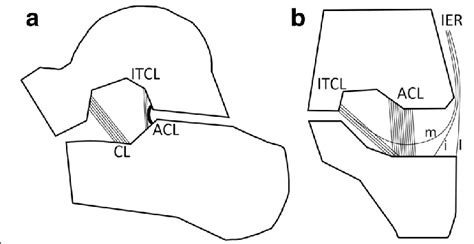 Schematic Illustration Of Ligaments Of The Sinus Tarsi A On The