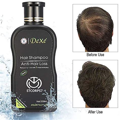Shampoo To Stop Hair Loss If Something Works For You Then Stick With