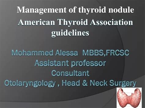 Ppt Management Of Thyroid Nodule Powerpoint Presentation Free