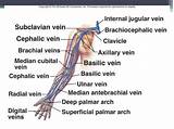 Photos of Brachial Vein Thrombosis Treatment