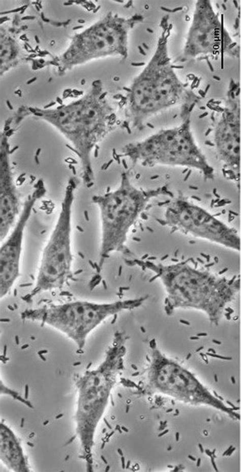 Bacterial Contamination Cell Culture