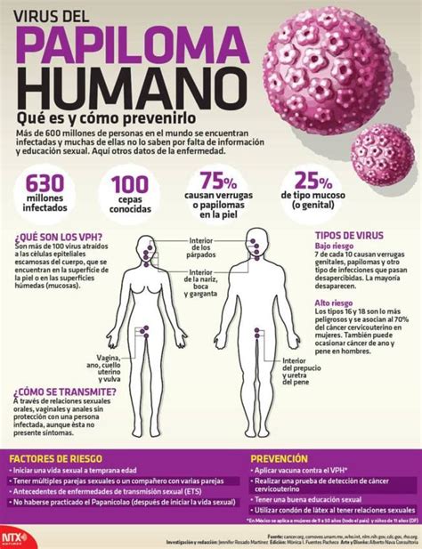 Infografia Virus Del Papiloma Humano Qu Es Y C Mo Prevenirlo