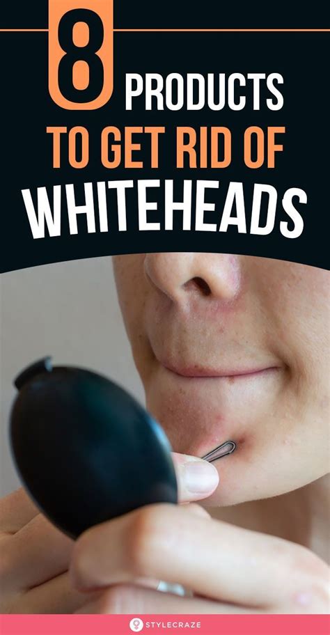 8 Best Products To Get Rid Of Whiteheads Quickly Whiteheads Beauty