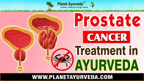 Ayurvedic View On Prostate Cancer Youtube