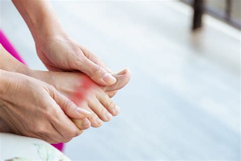 Gout Symptoms Causes And Treatment Apollo Hospitals Blog