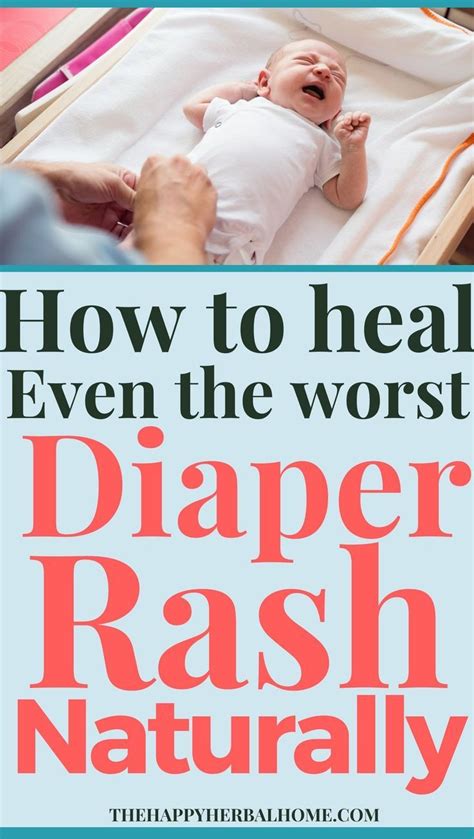 Treat A Bad Diaper Rash Quickly And Naturally Bad Diaper Rash Baby