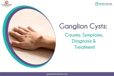Ganglion Cysts Causes Symptoms And Treatment