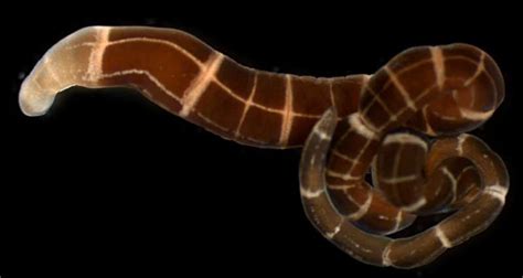 Scientists Find Worms That Recently Evolved The Ability To Regrow A