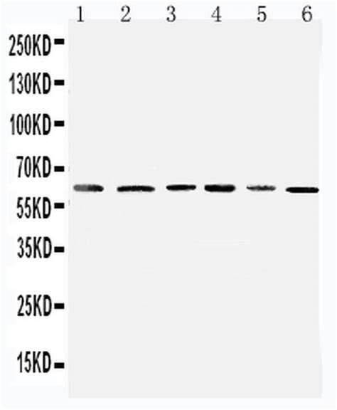 Pdk1 Polyclonal Antibody Pa5 79798