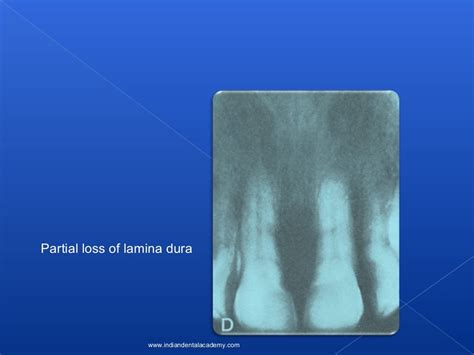 Lamina Dura Oral Surgery Courses