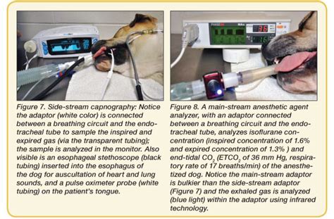 Anesthetic Monitoring Devices To Use And What The Results Mean Today