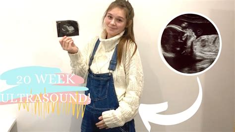 20 Week Pregnancy Ultrasound Youtube