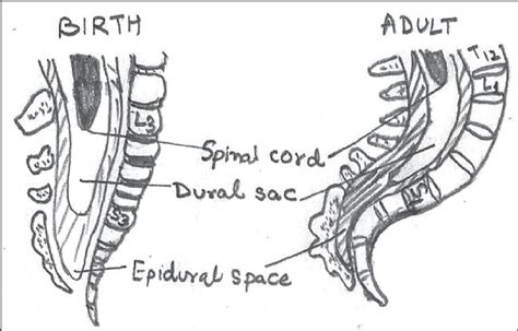 Neonatal Spine Anatomy Gallery