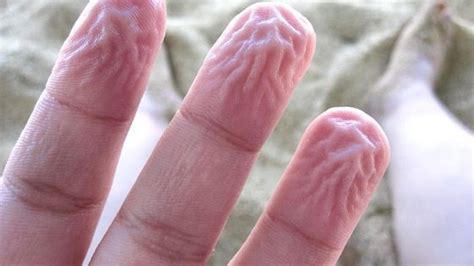 Ora sappiamo perché le dita in acqua diventano raggrinzite