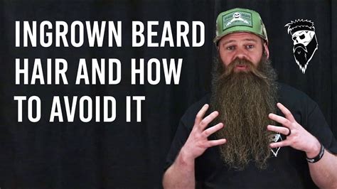 Ingrown Beard Hair And How To Avoid It Braw Beard Youtube