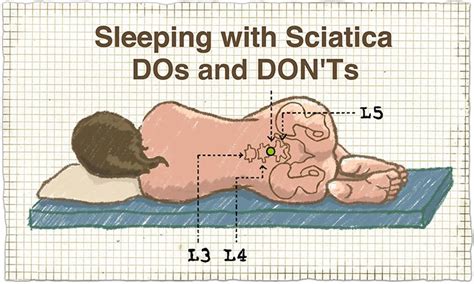 Talk with the team at orthobethesda to create a sleep plan that gives you relief. Sleeping with Sciatica - DOs and DON'Ts - The Health ...