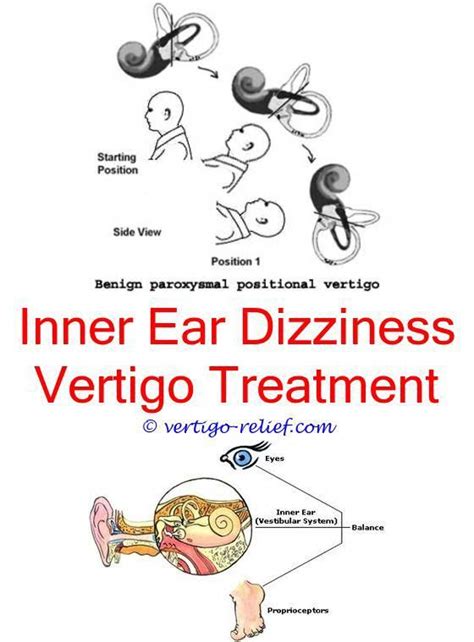 Pin On Tinnitus And Vertigo