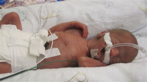 An Open Letter To Preemie Parents From A Micro Preemie Mom Huffpost