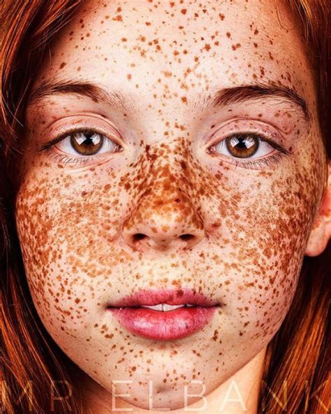 This Photographers Work Reveals The True Beauty Of People With Freckles