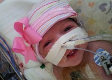 Baby Born With Heart Outside Her Body Survives