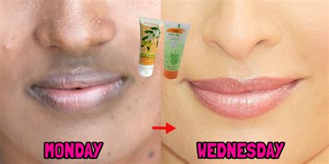 How To Hide Upper Lip Pigmentation With Makeup Saubhaya Makeup