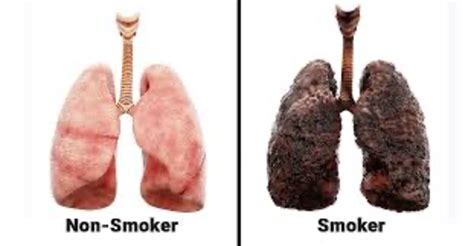 the effects of smoking and vaping on the respiratory system elink