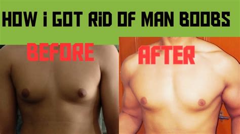 How To Get Rid Of Chest Fat And Gynecomastia 4 Simple Steps Youtube