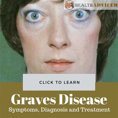 Graves Disease