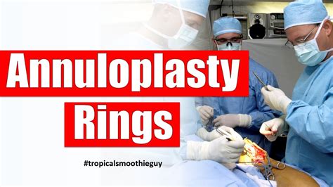 How Annuloplasty Rings Work For Mitral Valve Repair Youtube