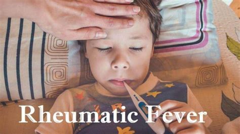 Rheumatic Fever Causes 4 Risk Factors Symptoms And Diagnosis 2024
