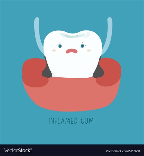 Inflamed Gum Of Dental Royalty Free Vector Image
