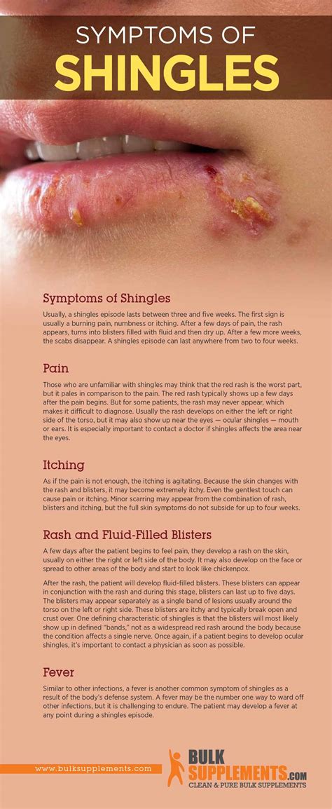 Shingles Causes Symptoms And Treatment By James Denlinger
