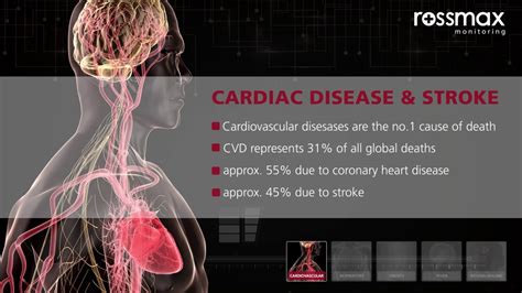 Disease Cardiovascular And Stroke Youtube