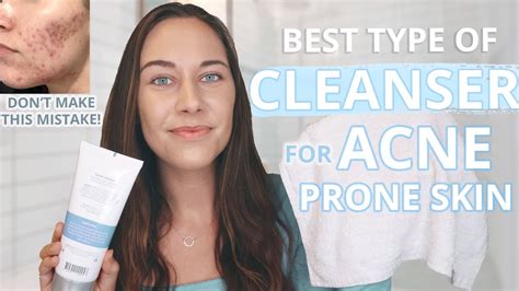 Best Cleanser For Acne Prone Skin Important Tips For Finding A Good