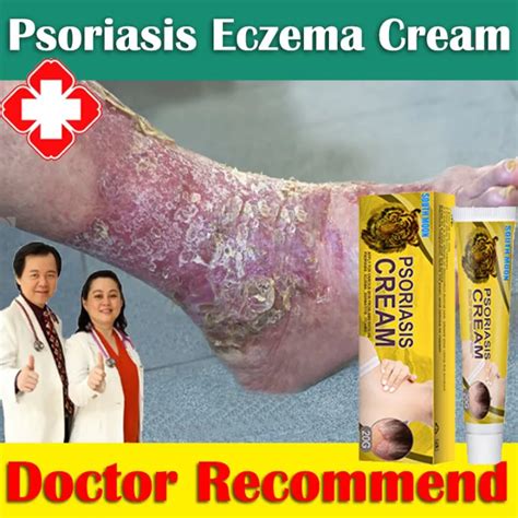 Psoriasis Eczema Cream 20g Ubat Gatal Gatal Kulit For Skin Disease