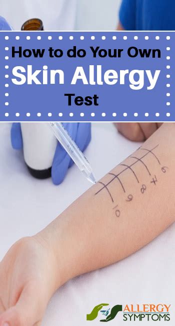 How To Do Your Own Skin Allergy Test Allergy Symptoms