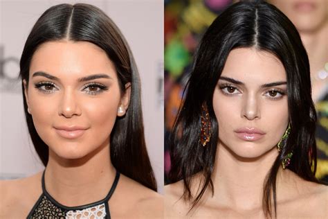 All The Kardashian Jenners Plastic Surgery Procedures Girlfriend