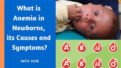 What Is Anemia In Newborns Its Causes And Symptoms Youtube
