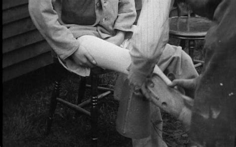 Artificial Limbs Of Ww1 With Images World War One Limb Veteran