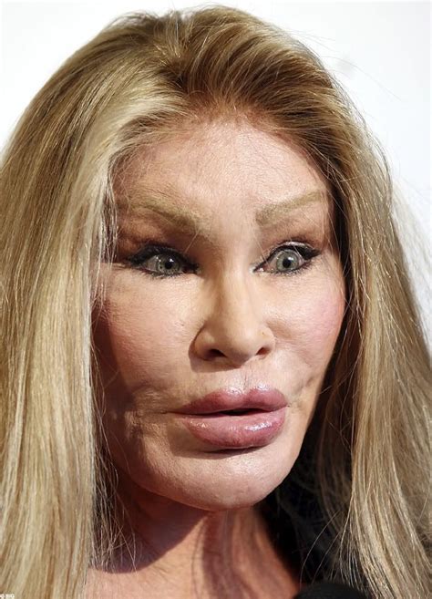 Plastic Surgery Gone Wrong Plastic Surgery Gone Wrong Celebrity