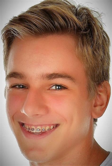 Guys With Braces Adult Braces Perfect Teeth Haircuts Box Pins Quick Orthodontics Teeth