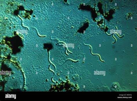 Light Micrograph Of Spirochaetes Bacteria Stock Photo Alamy