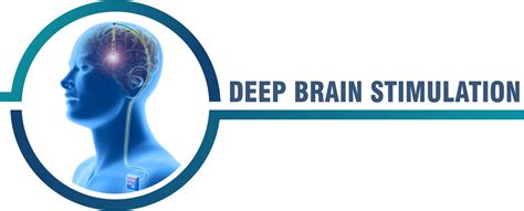 Deep Brain Stimulation Global Care