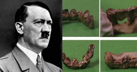 Hitler Era Vegetariano La Conferma Arriva Dai Suoi Denti