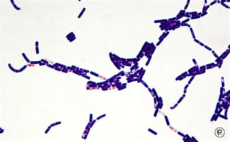 Gallery For Gram Positive Rods