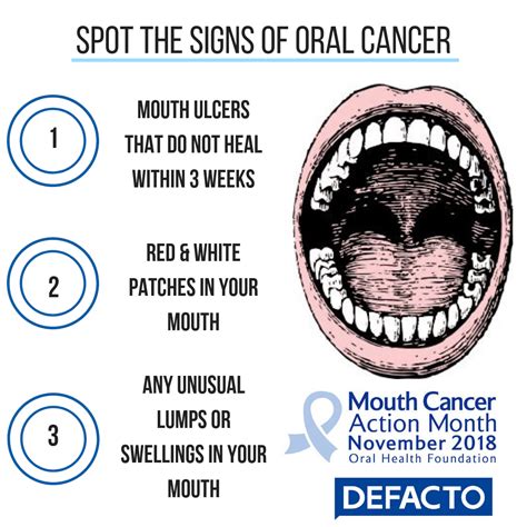 Why Are Levels Of Mouth Cancer On The Rise Defacto Dentists