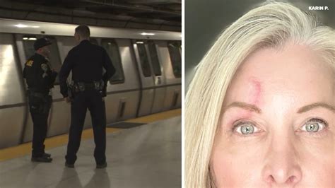 Woman Followed Attacked On Bart By Unknown Assailant Says She Won T Ride Again Abc7 San Francisco