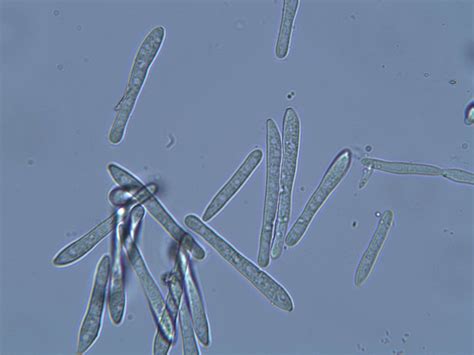 Micrograph of Spores