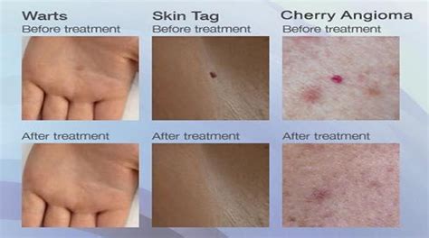 Viralitytoday Ever Wondered What Do The Red Dots On Your Skin Mean